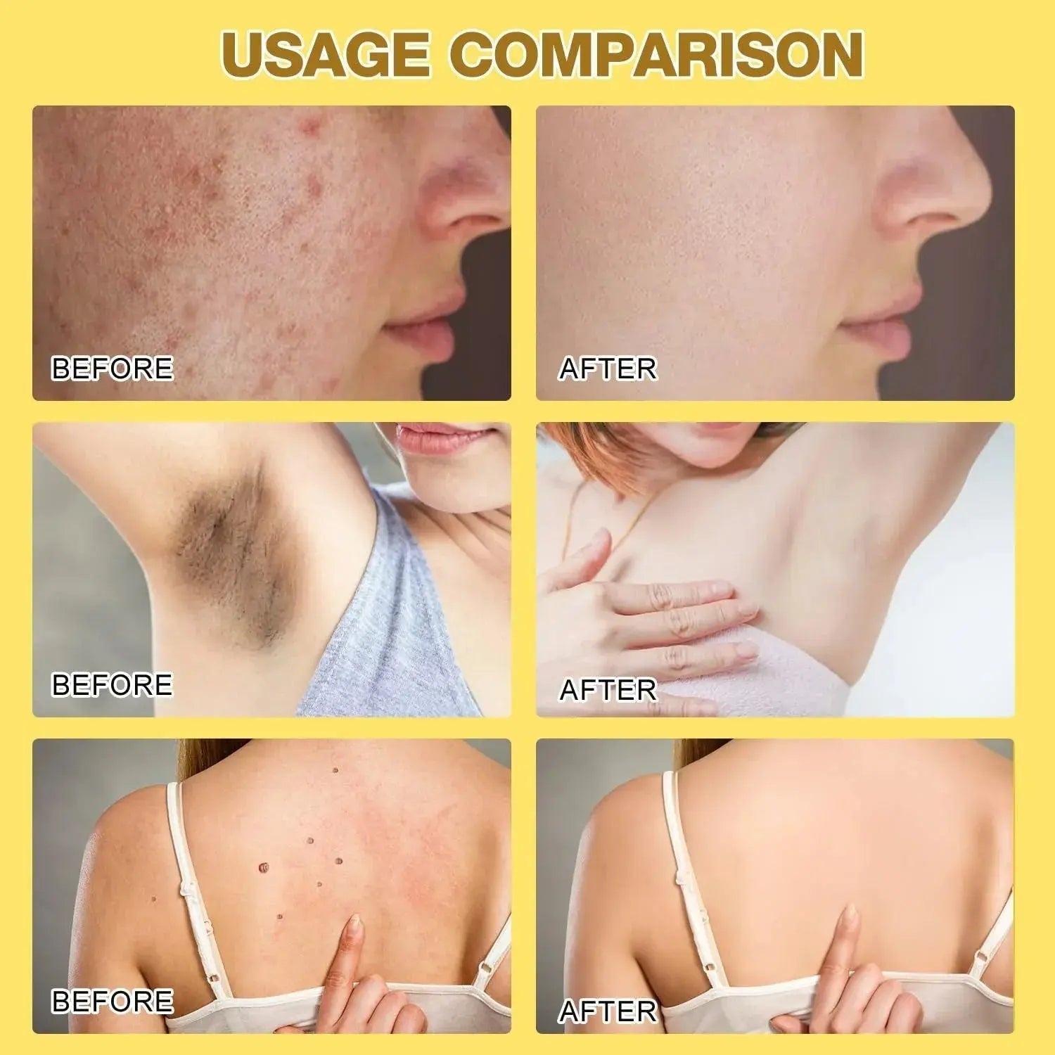 Bee Venom Skin Treatment Cream Zee Mart