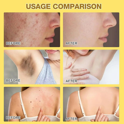 Bee Venom Skin Treatment Cream Zee Mart