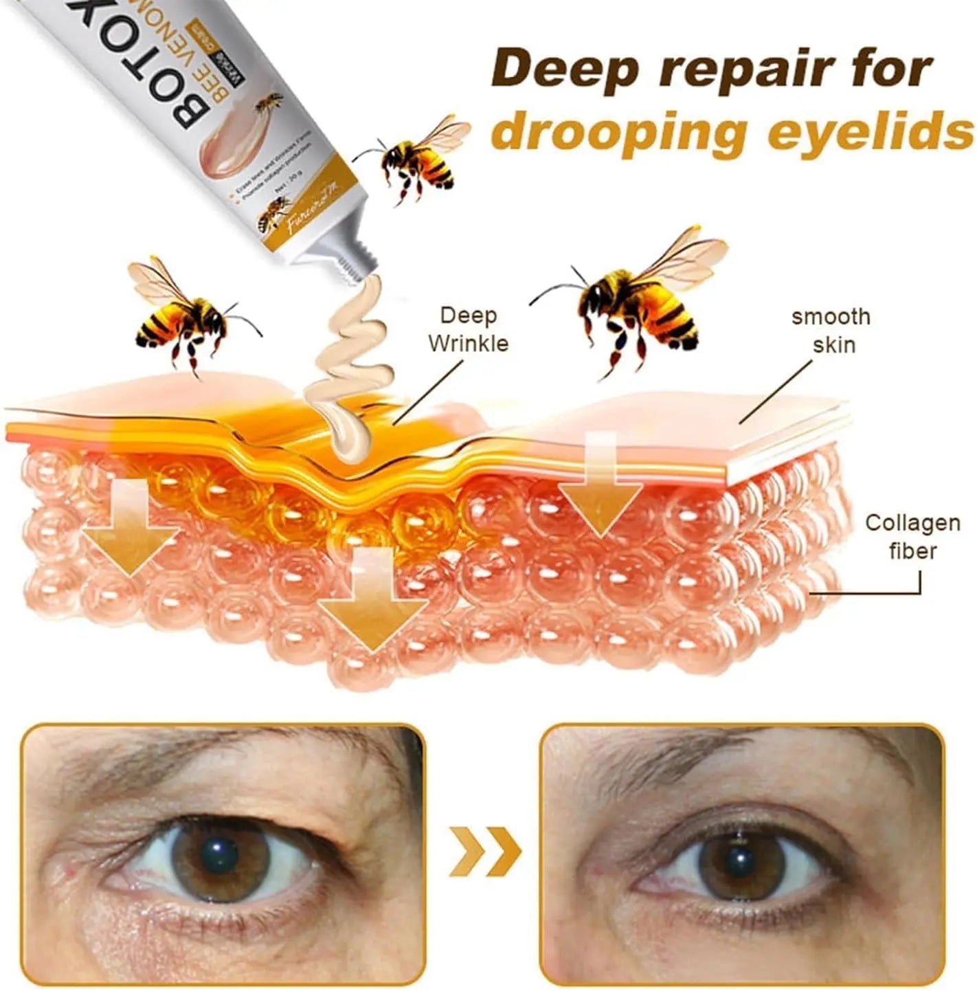 Botox Bee Venom Cream 💯 ORIGNAL Zee Mart