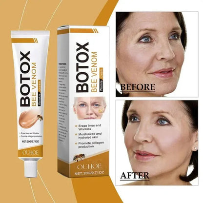 Botox Bee Venom Cream 💯 ORIGNAL Zee Mart